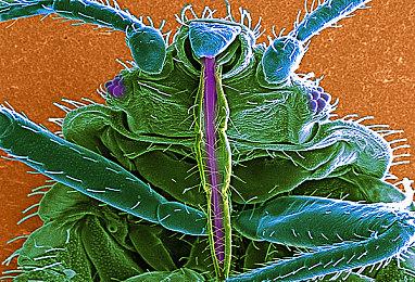 横版P言？《雾都残梦：心域突围》实机宣传片